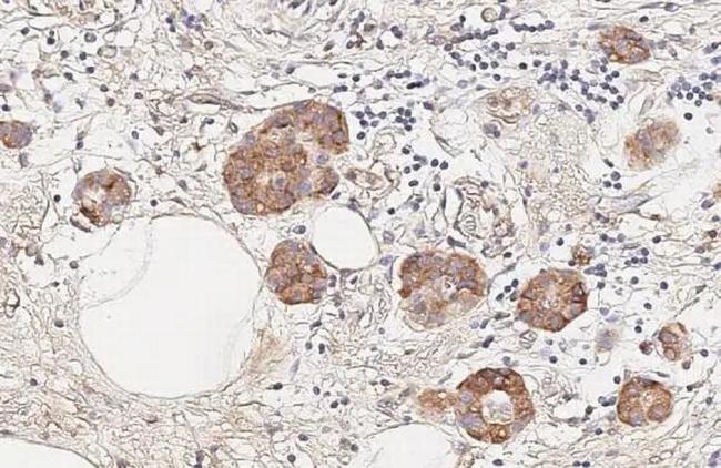 INSR beta Antibody in Immunohistochemistry (Paraffin) (IHC (P))