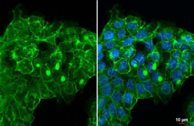 ITGB1 Antibody in Immunocytochemistry (ICC/IF)