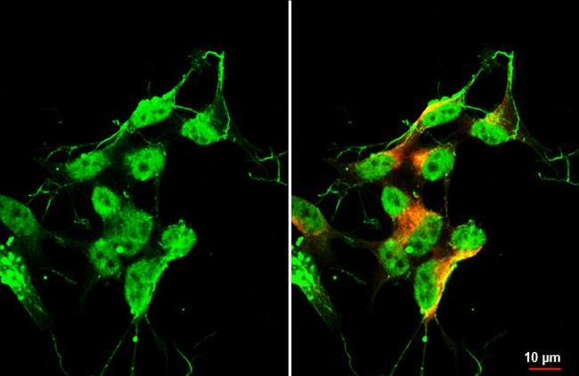 ISL1 Antibody in Immunocytochemistry (ICC/IF)