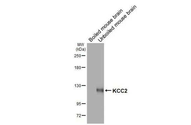 KCC2 Antibody in Western Blot (WB)