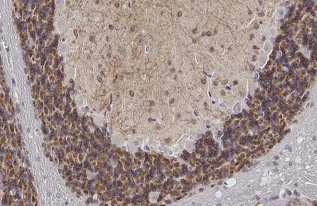 KCC2 Antibody in Immunohistochemistry (Paraffin) (IHC (P))