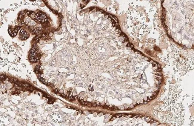 KISS1 Antibody in Immunohistochemistry (Paraffin) (IHC (P))