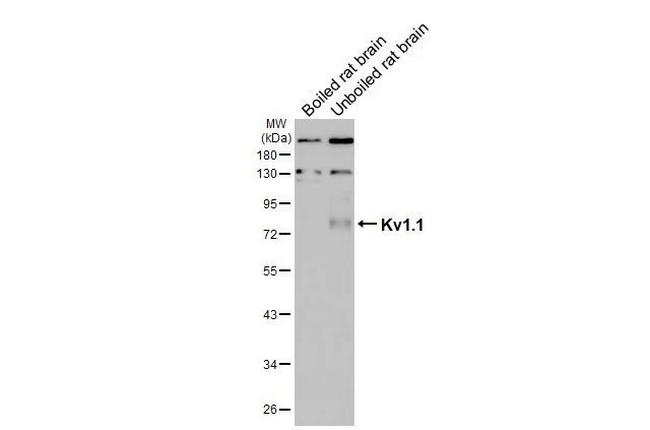 KV1.1 (KCNA1) Antibody in Western Blot (WB)