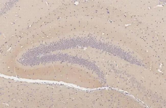 KV1.2 (KCNA2) Antibody in Immunohistochemistry (Paraffin) (IHC (P))