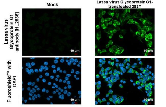 Lassa Virus Glycoprotein G1 (strain Mouse/Sierra Leone/Josiah/1976) Antibody in Immunocytochemistry (ICC/IF)