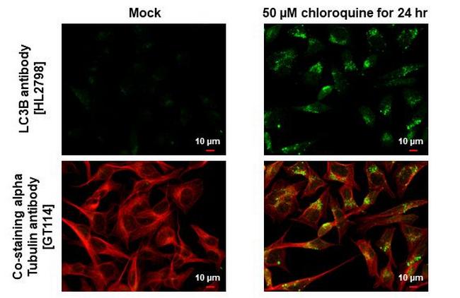 LC3B Antibody in Immunocytochemistry (ICC/IF)