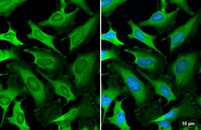 LDHA Antibody in Immunocytochemistry (ICC/IF)