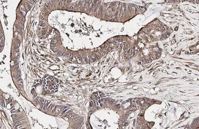 LGR6 Antibody in Immunohistochemistry (Paraffin) (IHC (P))