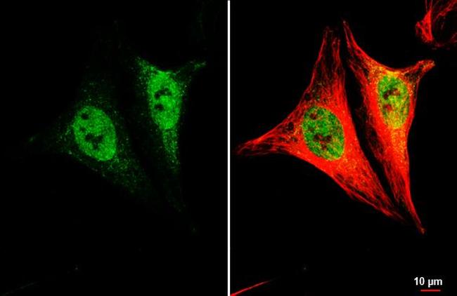 LSM4 Antibody in Immunocytochemistry (ICC/IF)