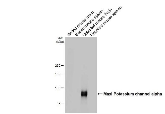 KCNMA1 Antibody in Western Blot (WB)
