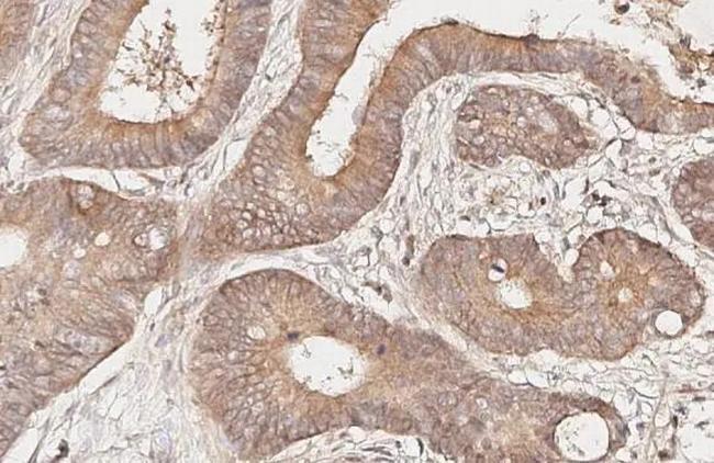 MC4R Antibody in Immunohistochemistry (Paraffin) (IHC (P))