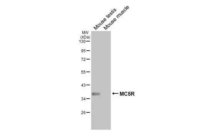 MC5R Antibody in Western Blot (WB)