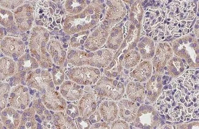 MCD Antibody in Immunohistochemistry (Paraffin) (IHC (P))