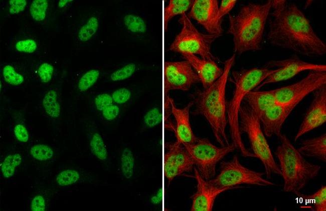 MEF2C Antibody in Immunocytochemistry (ICC/IF)
