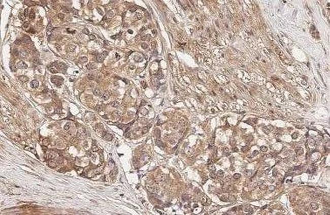 mGluR5 Antibody in Immunohistochemistry (Paraffin) (IHC (P))