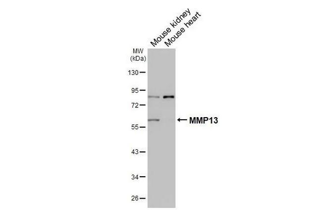 MMP13 Antibody in Western Blot (WB)