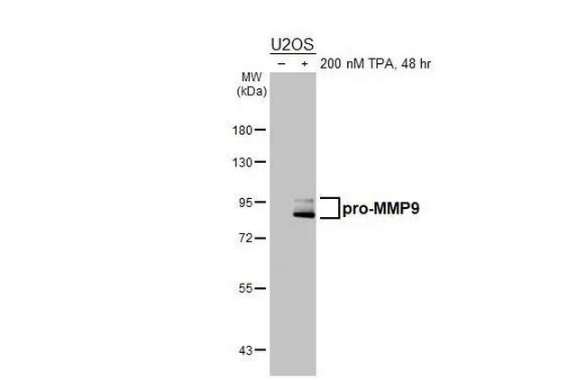 MMP9 Antibody in Western Blot (WB)