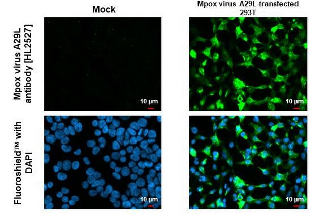 Monkeypox Virus A29L (MPXV/USA/2022/MA001) Antibody in Immunocytochemistry (ICC/IF)