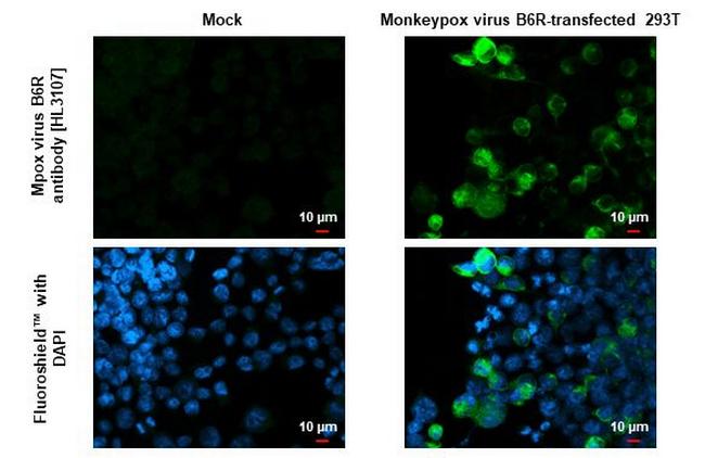 Monkeypox Virus B6R (strain Zaire-96-I-16) Antibody in Immunocytochemistry (ICC/IF)
