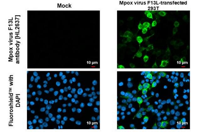 Monkeypox Virus F13L (MPXV/USA/2022/MA001) Antibody in Immunocytochemistry (ICC/IF)