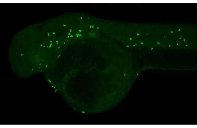 MPX Antibody in Immunohistochemistry (IHC)