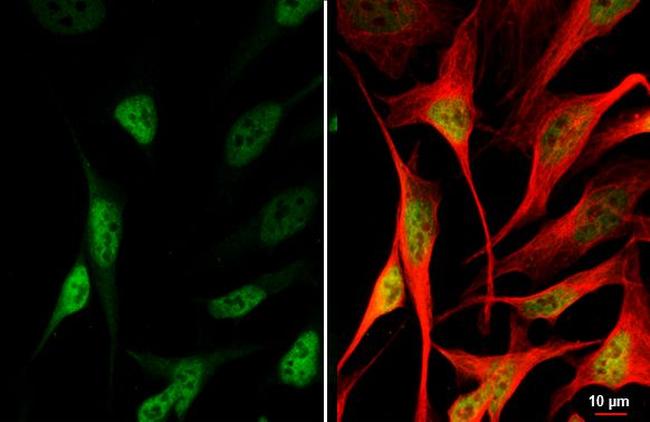 MRE11 Antibody in Immunocytochemistry (ICC/IF)