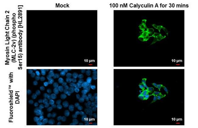 Phospho-MYL2 (Ser15) Antibody in Immunocytochemistry (ICC/IF)