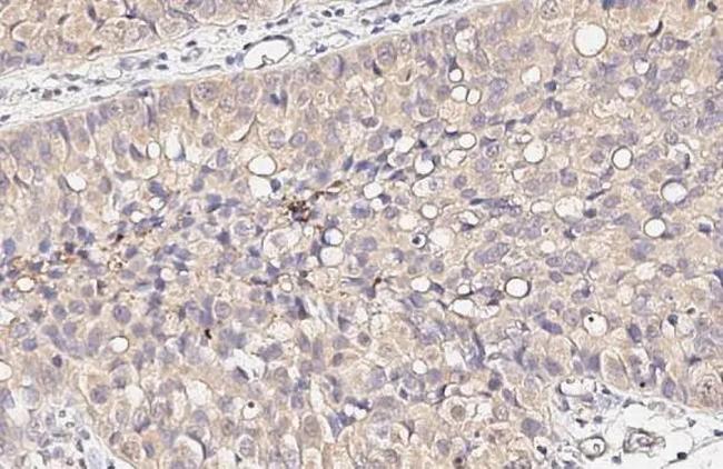 CALCOCO2 Antibody in Immunohistochemistry (Paraffin) (IHC (P))