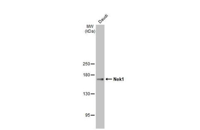 NEK1 Antibody in Western Blot (WB)
