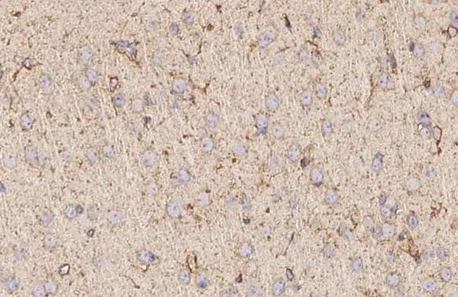 TACR1 Antibody in Immunohistochemistry (Paraffin) (IHC (P))