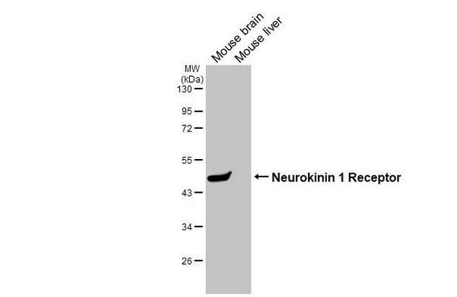 TACR1 Antibody in Western Blot (WB)