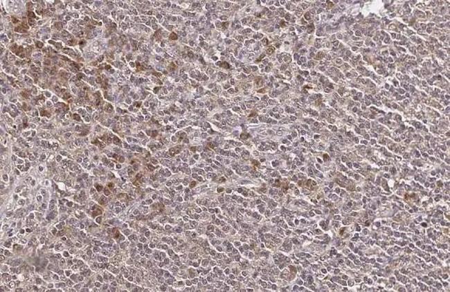 NKG2A Antibody in Immunohistochemistry (Paraffin) (IHC (P))