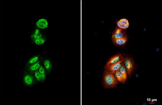 p27Kip1 Antibody in Immunocytochemistry (ICC/IF)