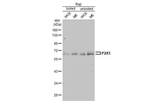 P2X5 Antibody in Western Blot (WB)