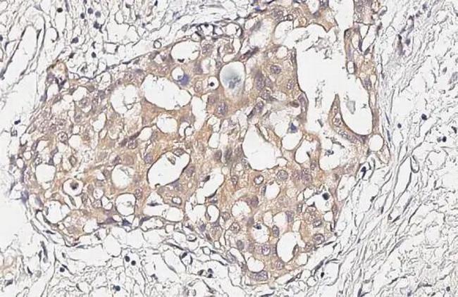 P2Y11 Antibody in Immunohistochemistry (Paraffin) (IHC (P))
