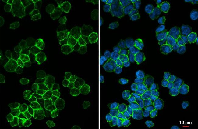P2Y12 Antibody in Immunocytochemistry (ICC/IF)