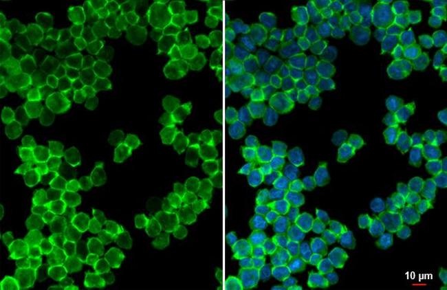 P2Y2 Antibody in Immunocytochemistry (ICC/IF)