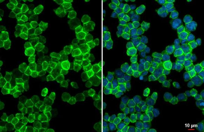 P2Y2 Antibody in Immunocytochemistry (ICC/IF)