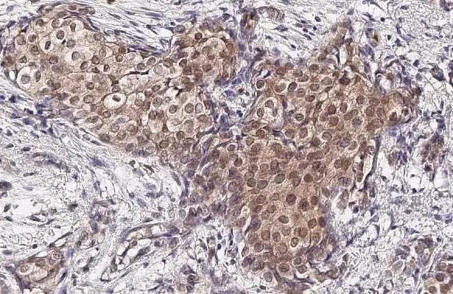 Phospho-p38 MAPK (Tyr182) Antibody in Immunohistochemistry (Paraffin) (IHC (P))