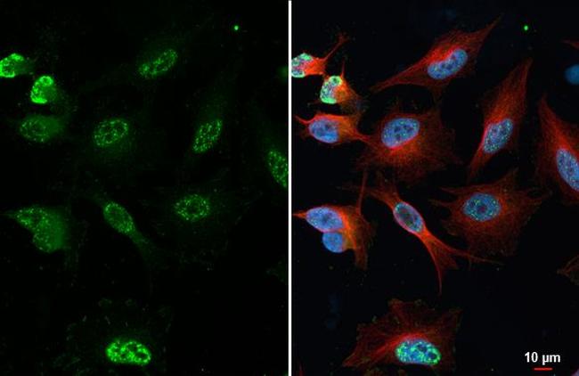 Phospho-p38 MAPK (Tyr182) Antibody in Immunocytochemistry (ICC/IF)