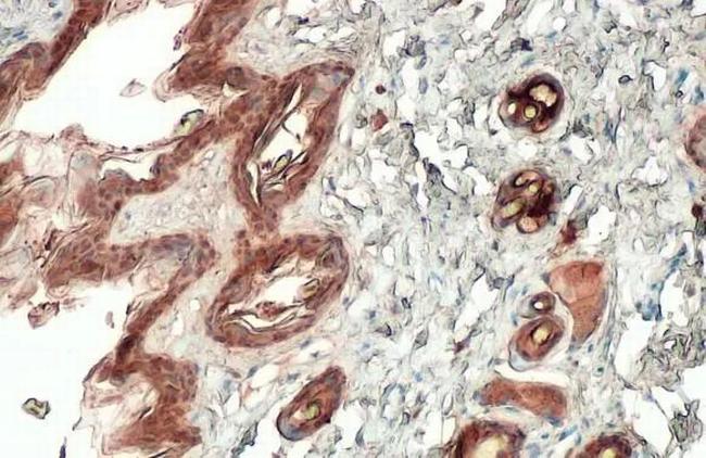 Cytokeratin Pan Type I/II Antibody in Immunohistochemistry (Paraffin) (IHC (P))