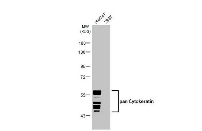Cytokeratin Pan Type I/II Antibody in Western Blot (WB)
