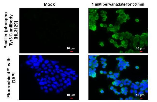 Phospho-Paxillin (Tyr31) Antibody in Immunocytochemistry (ICC/IF)