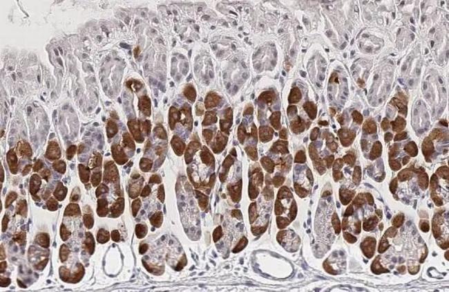 PCSK9 Antibody in Immunohistochemistry (Paraffin) (IHC (P))