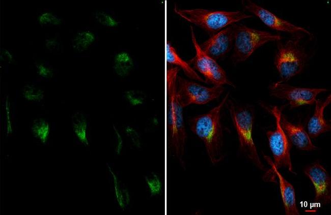 PCSK9 Antibody in Immunocytochemistry (ICC/IF)