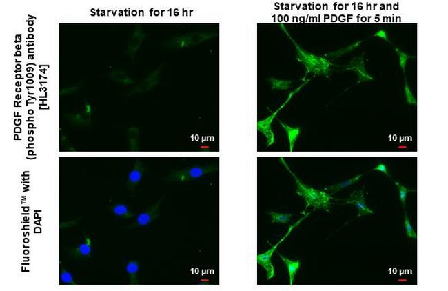 Phospho-PDGFRB (Tyr1009) Antibody in Immunocytochemistry (ICC/IF)