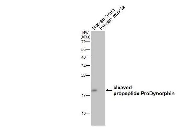 Prodynorphin Antibody in Western Blot (WB)