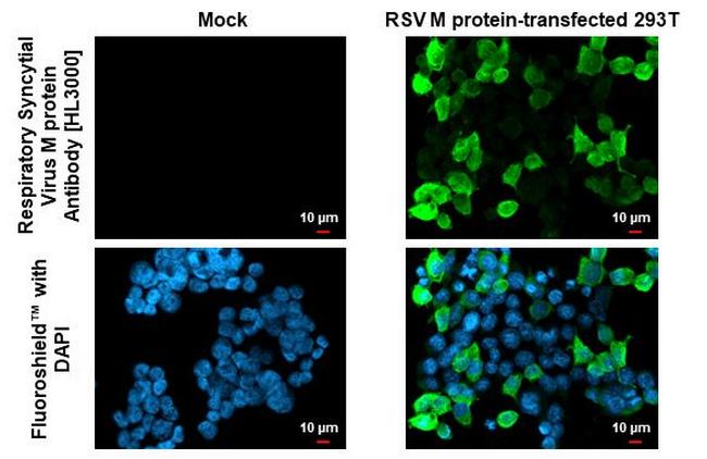 RSV M Protein Antibody in Immunocytochemistry (ICC/IF)