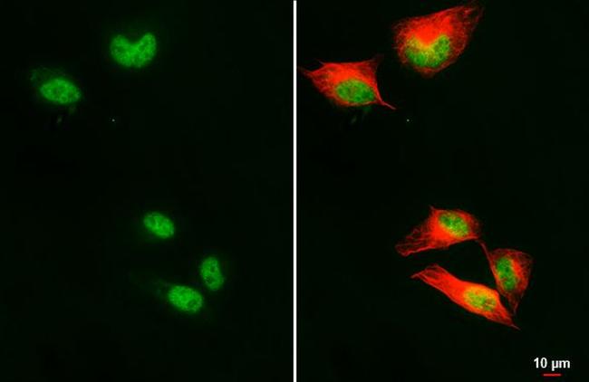 RFC1 Antibody in Immunocytochemistry (ICC/IF)