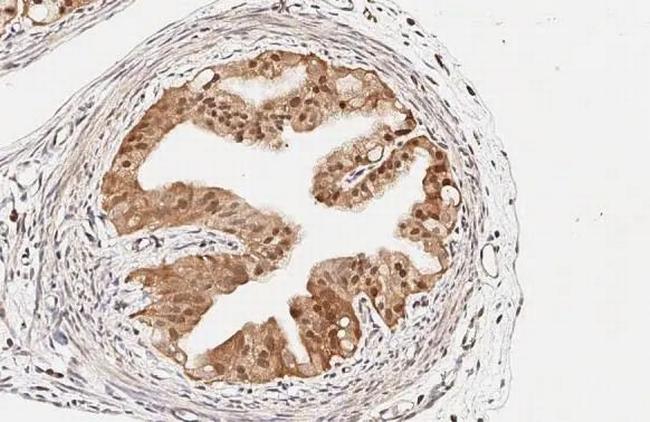 RGS2 Antibody in Immunohistochemistry (Paraffin) (IHC (P))
